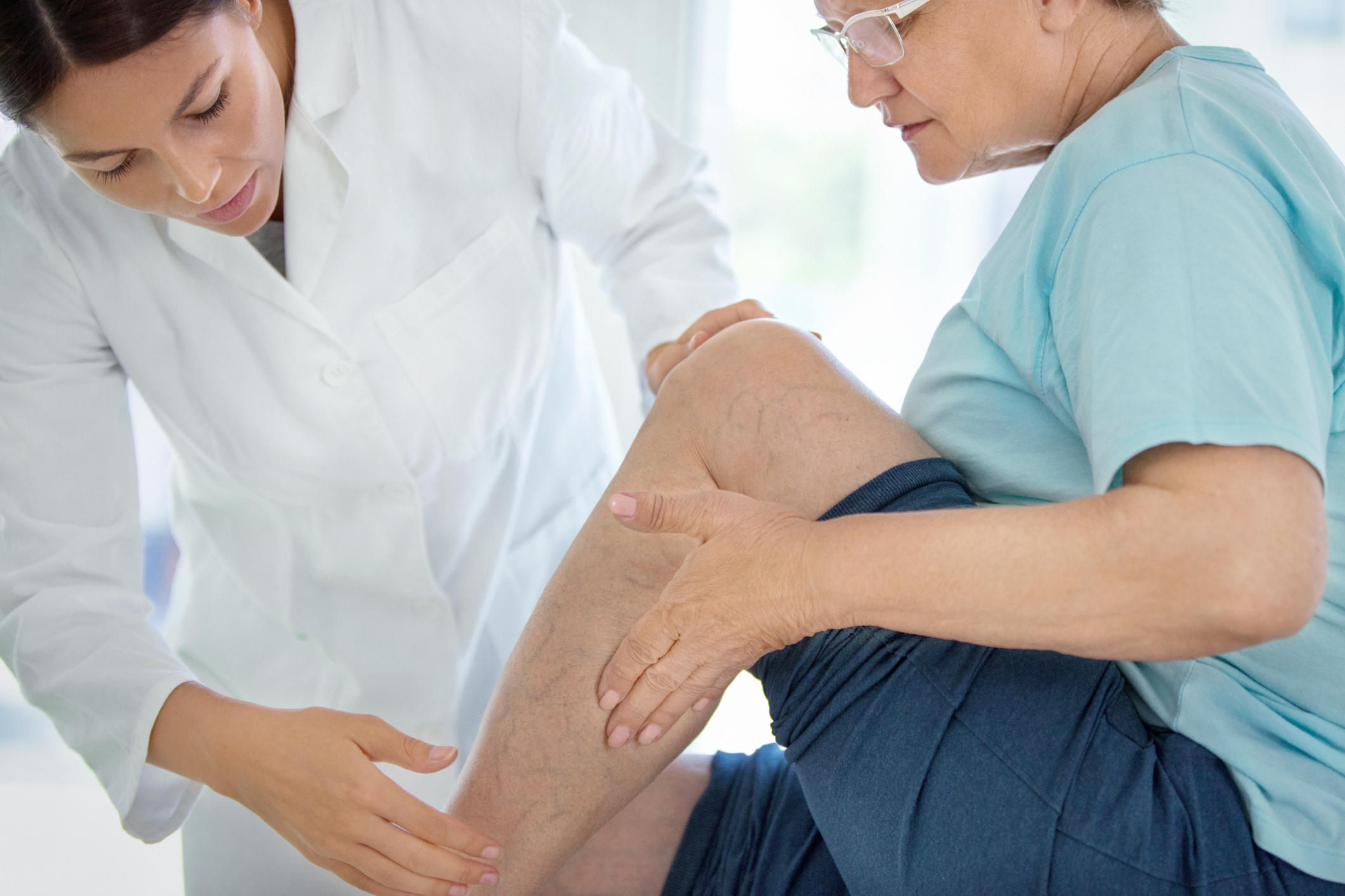 what kind of doctor treats varicose veins