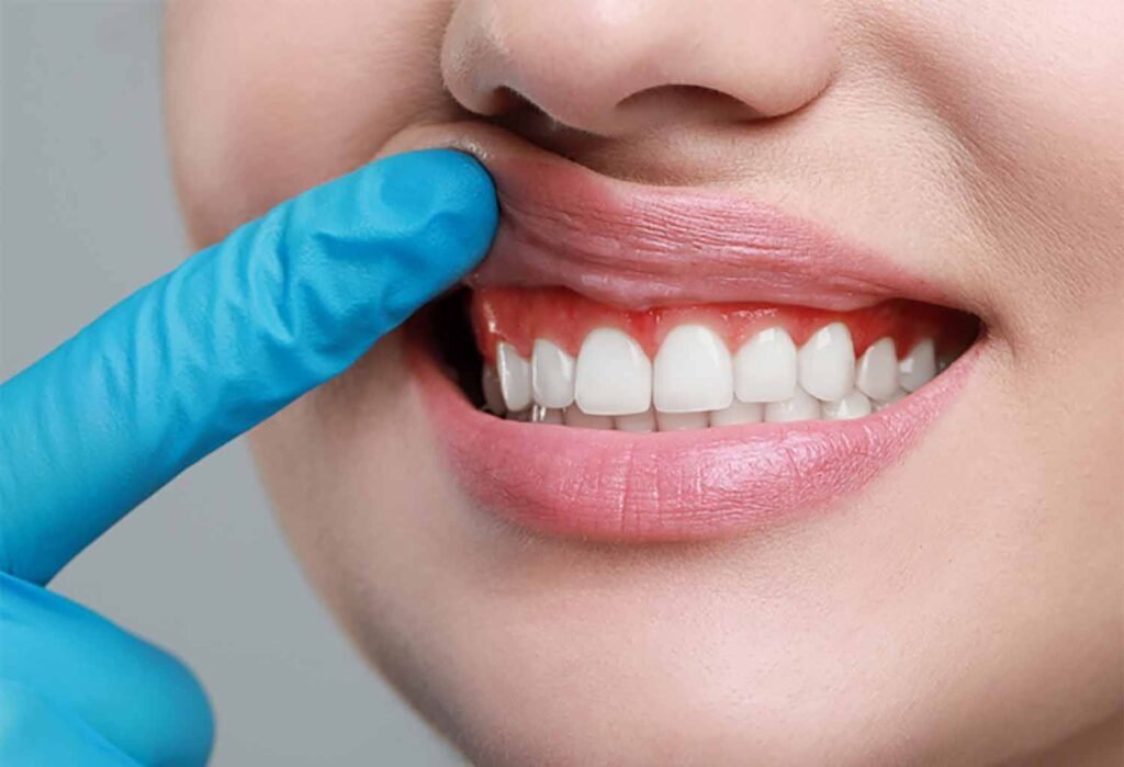 buckhead family and cosmetic dentistry